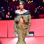 How did Zazie Beetz burn herself on the set of Deadpool 2?